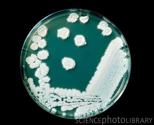 Candida hongo mujer, yeast candida krusei, candida albicans illness